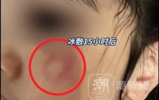 5岁女孩学乒乓球被教练打脸？家长质疑教练行为